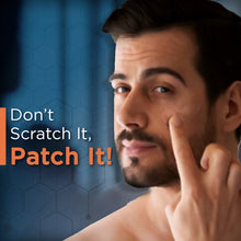 Load image into Gallery viewer, Acne Pimple Patch, 72 Dots